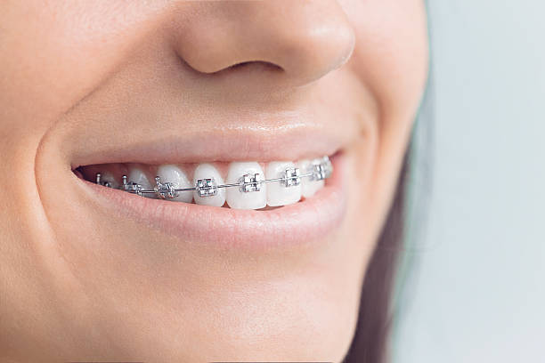 Best Traditional Braces  in Warrensburg, IL